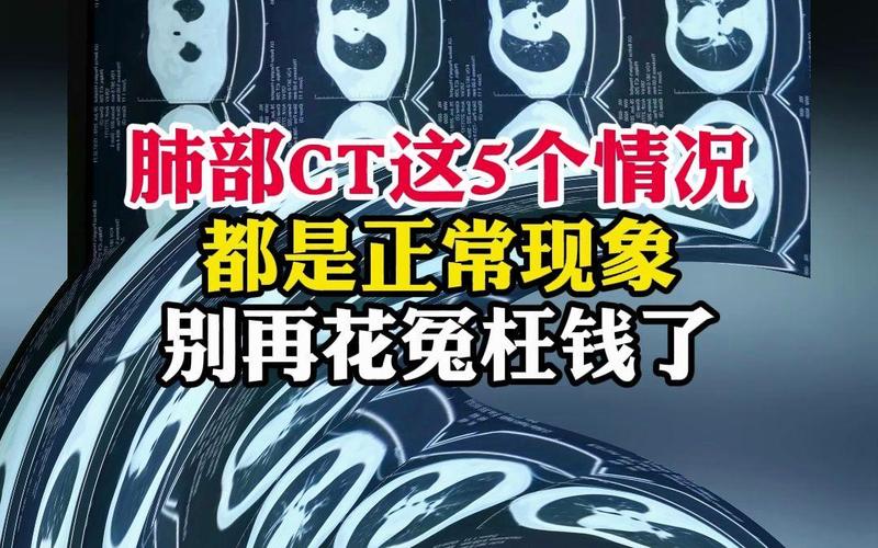 基因检测机构哪家好_基因检测公司结果都一样吗_基因检测公司那个好